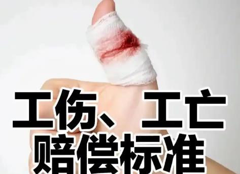 临时工工伤死亡赔偿标准2025最新