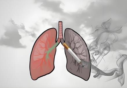 尘肺病赔偿标准2025最新 